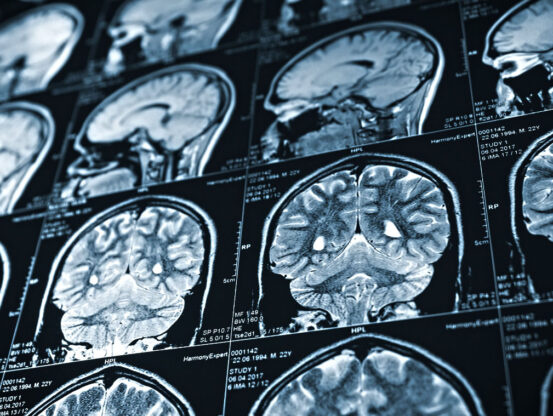 Human hormone could become first treatment for brain injury